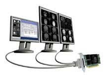 Display Controller Boards for Medical Imaging